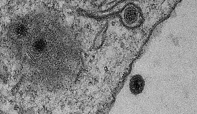 یارا ویروس ( Yaravirus ) ویروسی با ژن های ناشناخته در آمیب | موسسه ...